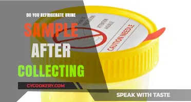 Should You Refrigerate Urine Samples? Proper Collection and Storage Tips