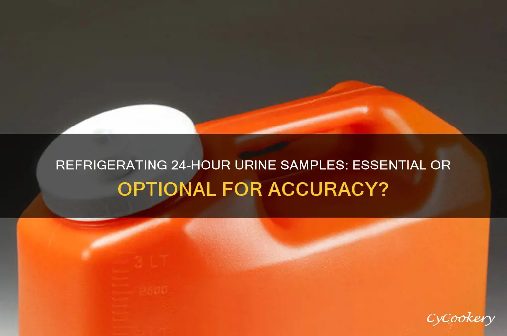 does 24 hour urine sample have to be refrigerated