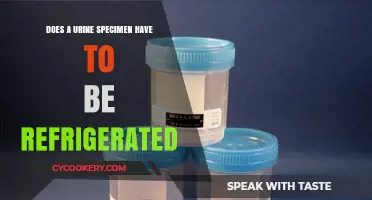 Urine Specimen Storage: Does Refrigeration Preserve Accuracy and Reliability?