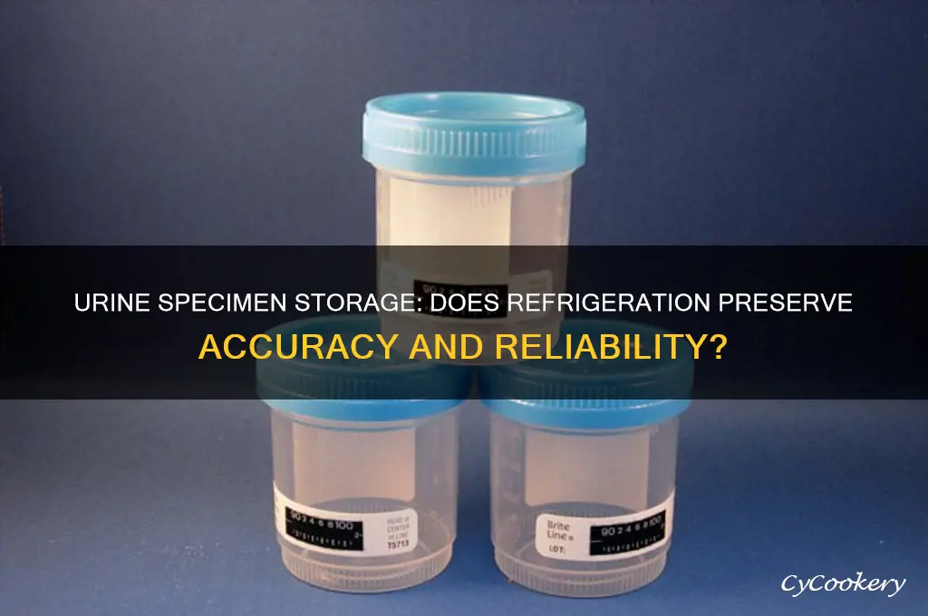 does a urine specimen have to be refrigerated