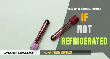 Unrefrigerated Blood Samples: Risks and Implications for Men's Health