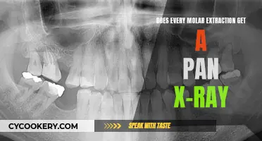 Molar Extraction: When is a Pan X-ray Necessary?