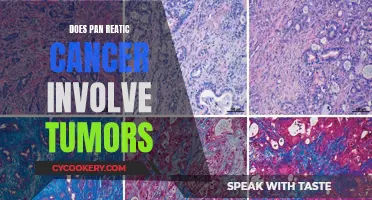 Pancreatic Cancer: Tumors and Their Impact