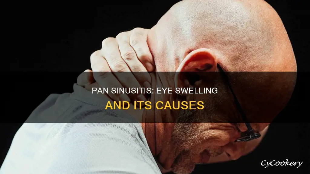 does pan sinuses cause swelling of the eyes
