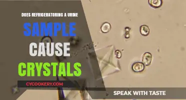 Refrigerating Urine Samples: Does It Lead to Crystal Formation?