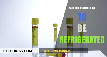 Urine Sample Storage: Does Refrigeration Preserve Accuracy and Reliability?