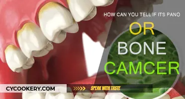 Differentiating Bone and Pancreatic Cancer: Key Symptoms