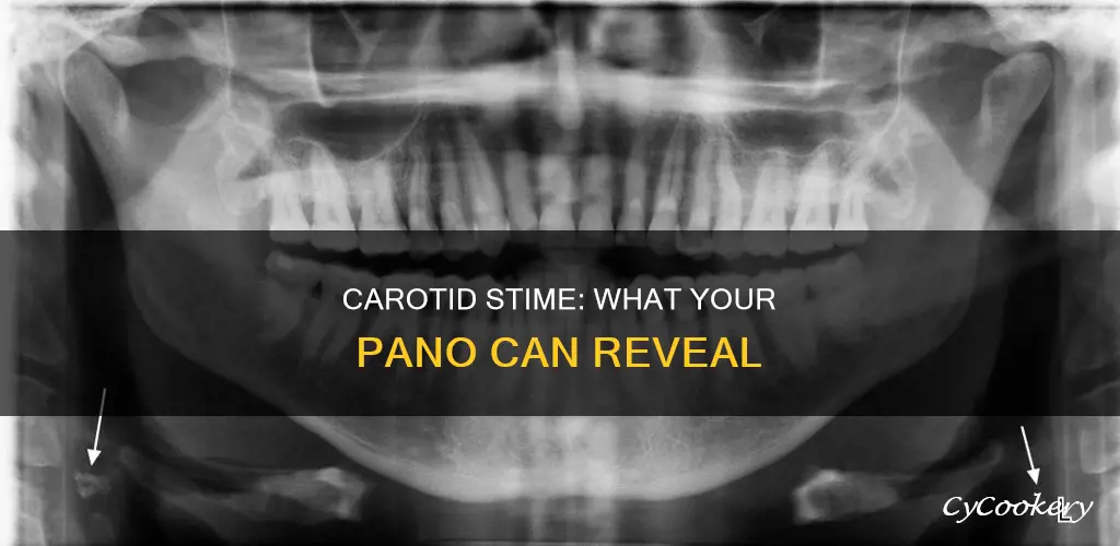how carotid stime looks in pano
