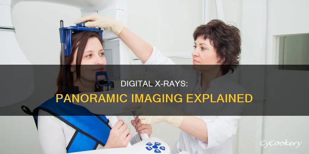how do digital xrays works pano
