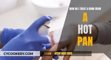 Treating Burns: Quick Response to Hot Pan Injuries