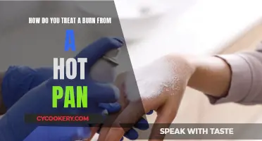 Treating Burns: Quick Response to Kitchen Accidents