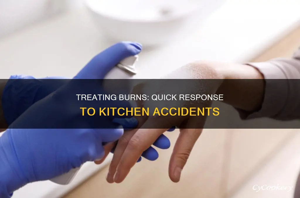 how do you treat a burn from a hot pan