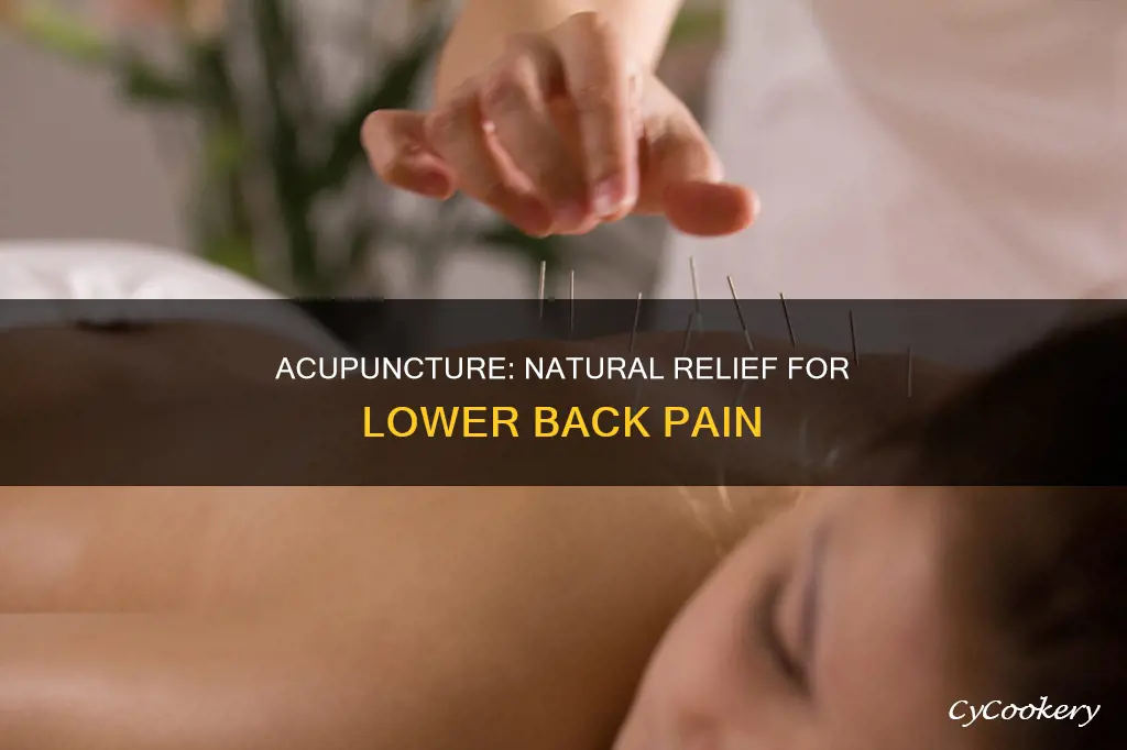 how does acupuncture help lower back pan