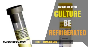 Refrigerating Urine Cultures: Optimal Storage Duration for Accurate Test Results