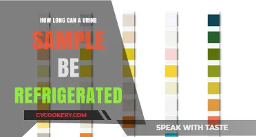 Refrigerating Urine Samples: How Long Can They Stay Fresh?