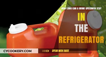 Refrigerated Urine Specimen Storage: How Long is Too Long?