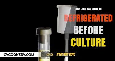 Refrigerating Urine for Culture: Optimal Storage Time and Guidelines