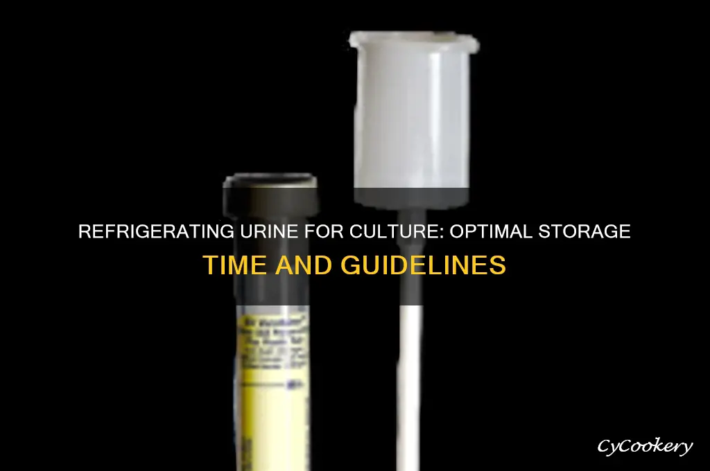how long can urine be refrigerated before culture
