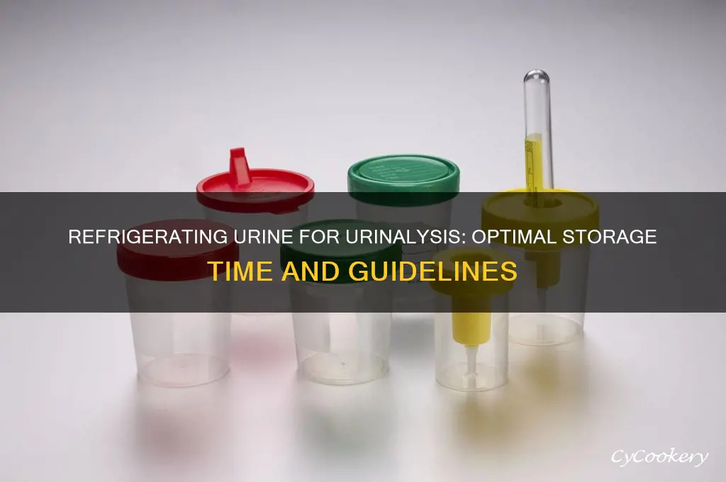 how long can urine be refrigerated for urinalysis