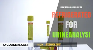 Refrigerating Urine for Analysis: Optimal Storage Duration Explained