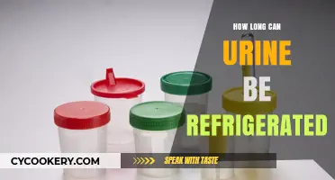 Refrigerating Urine: How Long Can It Be Stored Safely?