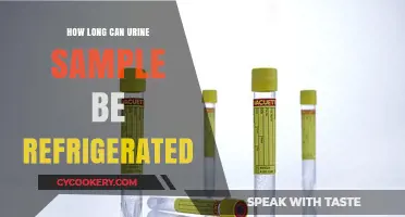 Refrigerating Urine Samples: Optimal Storage Duration for Accurate Test Results