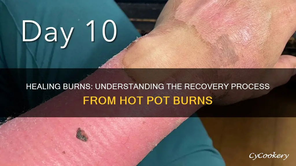 how long does a burn take to heal hot pot