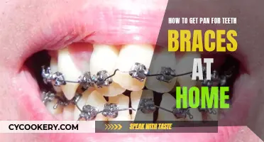 Teeth Braces: DIY Pan Molding at Home