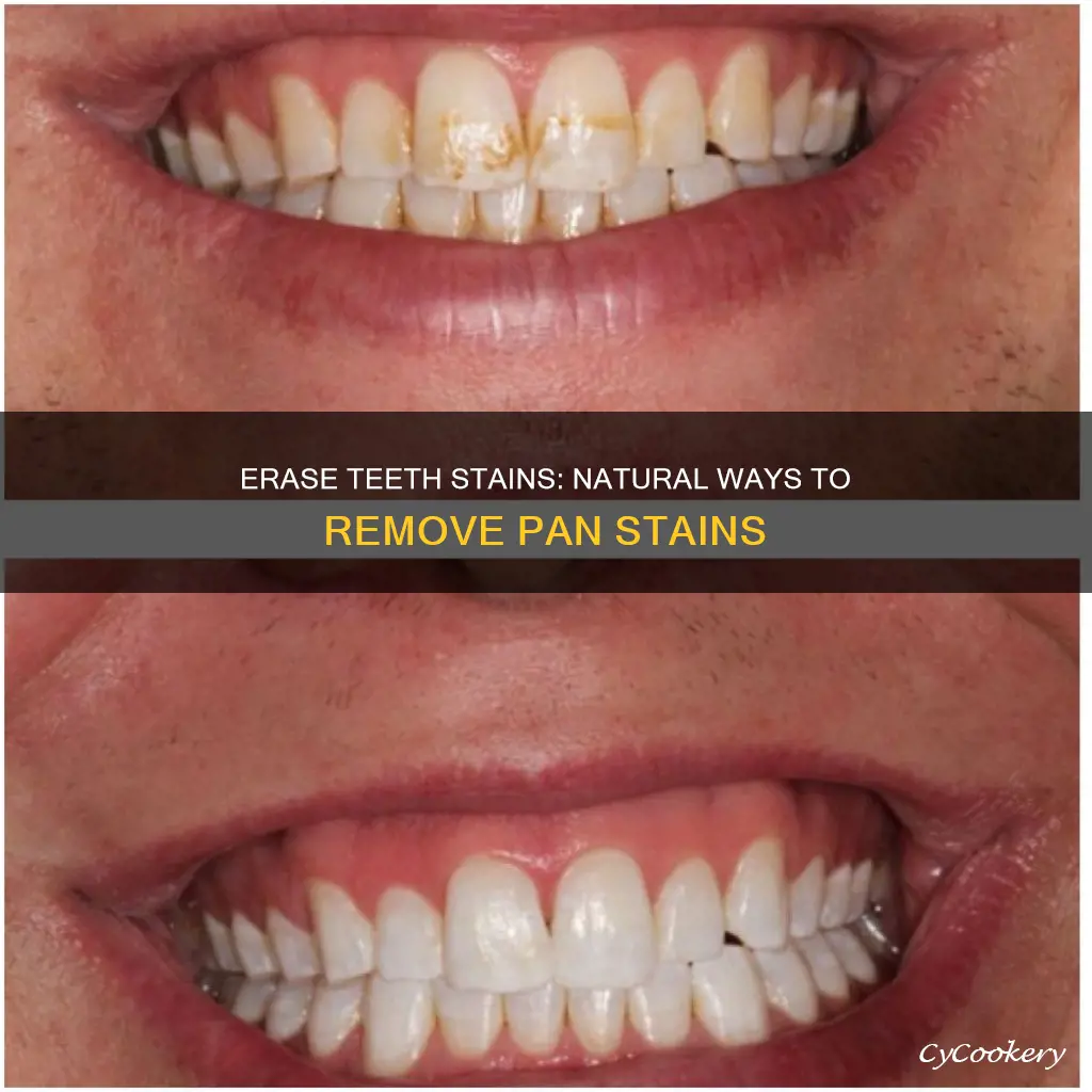 how to get rid of pan stains on teeth