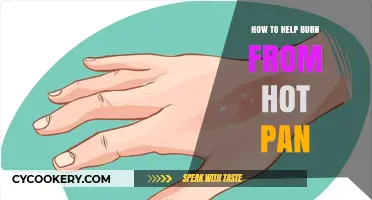 Quick Tips to Treat Burns from Hot Pans