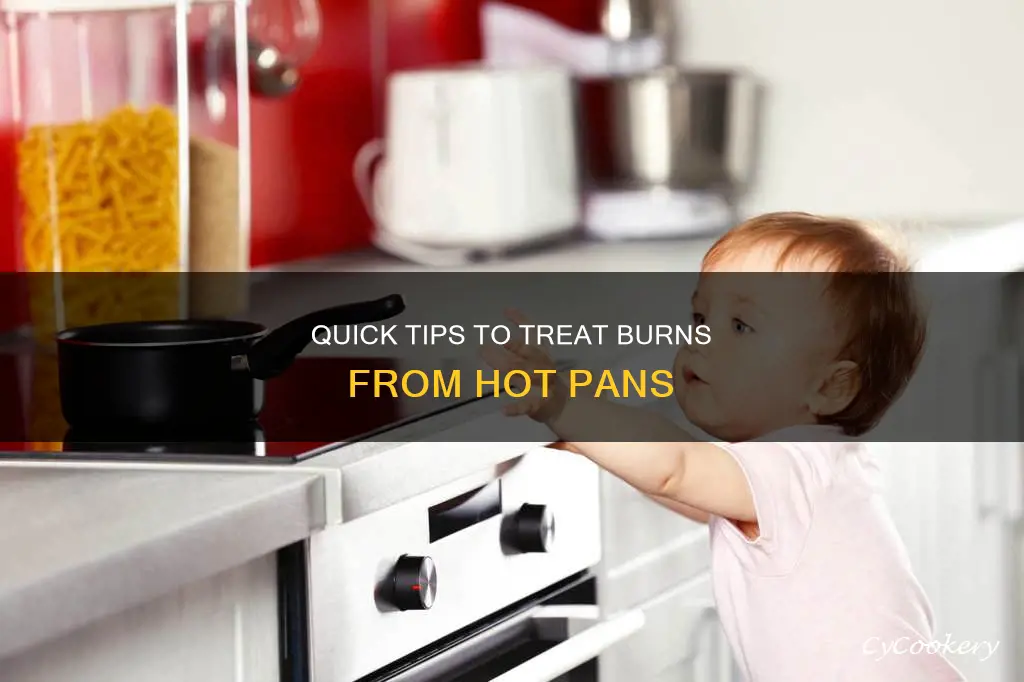how to help burn from hot pan