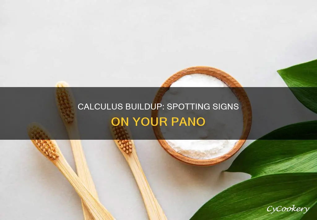 how to identify calculus buildup on pano