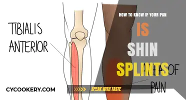 Shin Splints: How to Identify and Treat Them