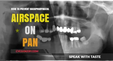 Preventing Nasopharyngeal Airspace on PAN Scans