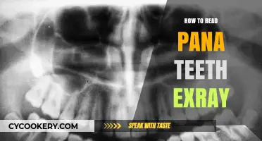 Understanding Panoramic X-Rays: A Guide