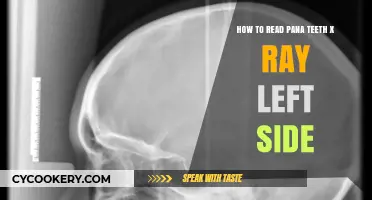 Understanding Pana Teeth X-Rays: Left Side