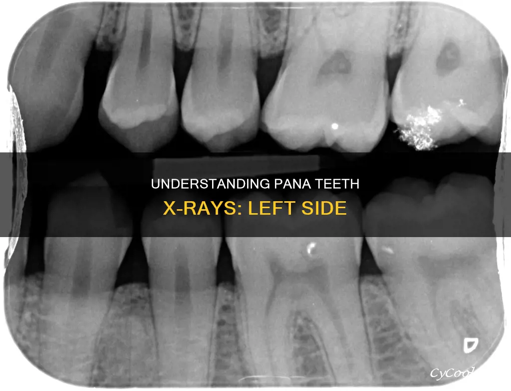 how to read pana teeth x ray left side