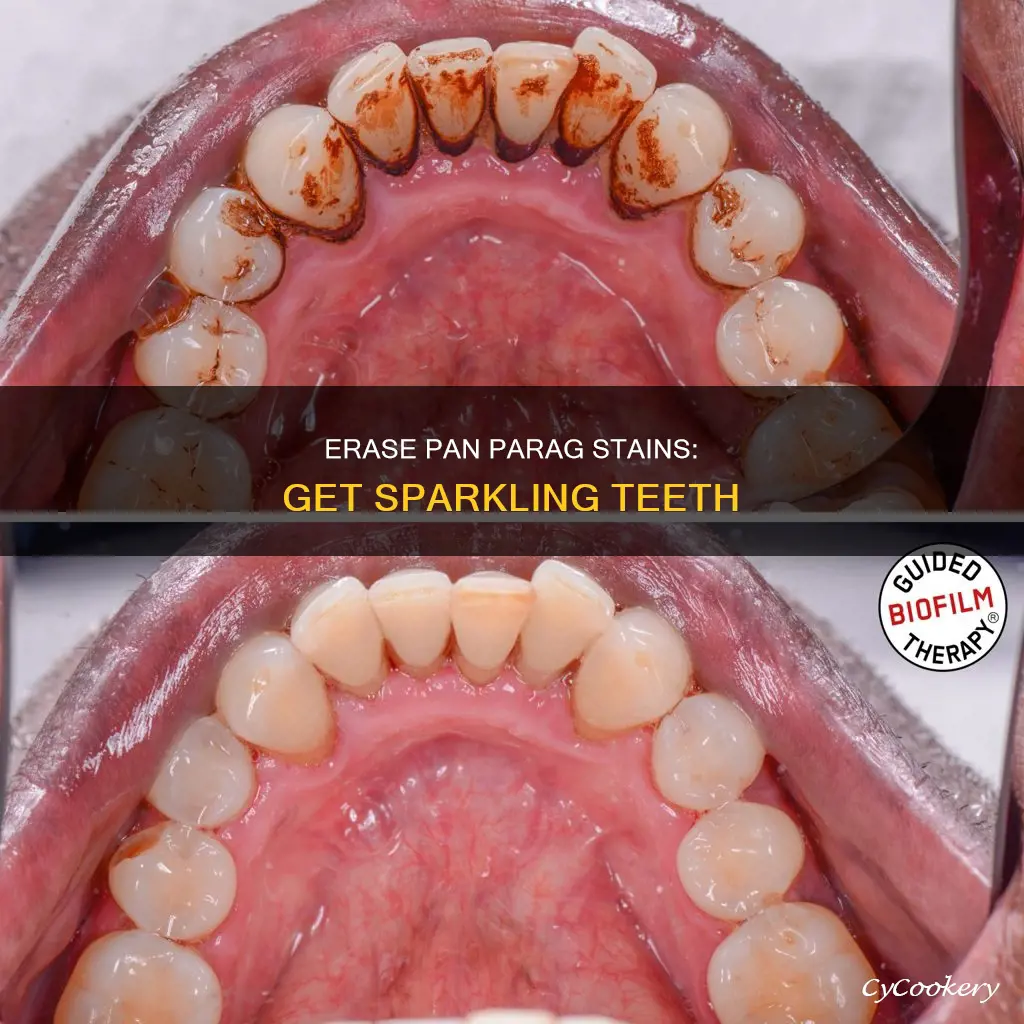 how to remove pan parag stains from teeth