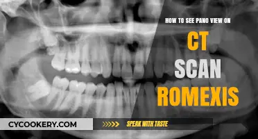 Unlocking Panoramic CT Views with Romexis Software