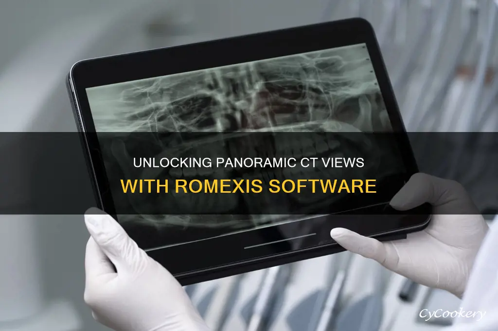 how to see pano view on ct scan romexis