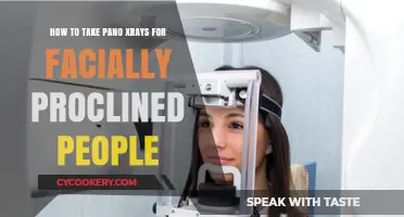 Taking Panoramic X-rays for Proclined Patients: A Guide