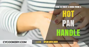 Treating Burns: Quick Action for Hot Pan Handle Injuries