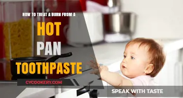Treating Burns: Quick Home Remedy Using Toothpaste