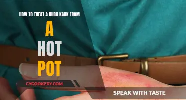 Treating a Hot Pot Burn: Quick Response for Effective Healing