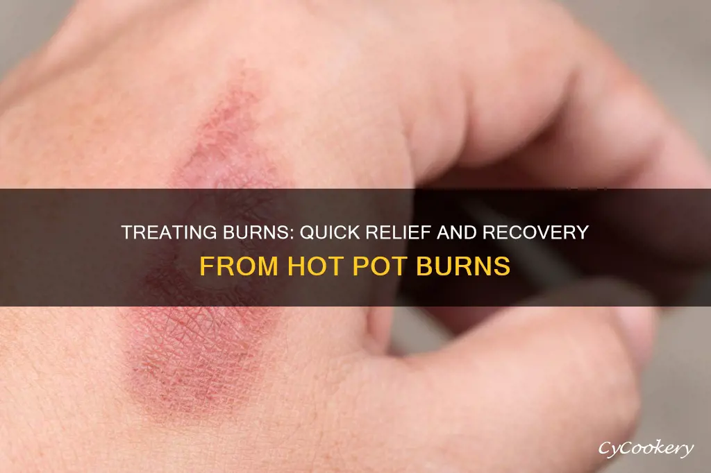 how to treat burn from hot pot