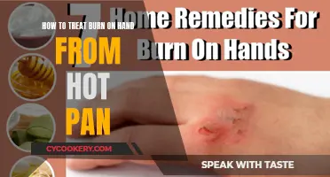 Treating Hand Burns: Quick Response to Hot Pan Accidents