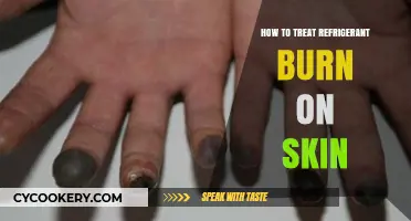 Treating Refrigerant Burns: Immediate Steps and Skin Care Tips