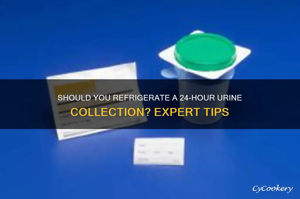 must i refrigerate 24 hour urine collection