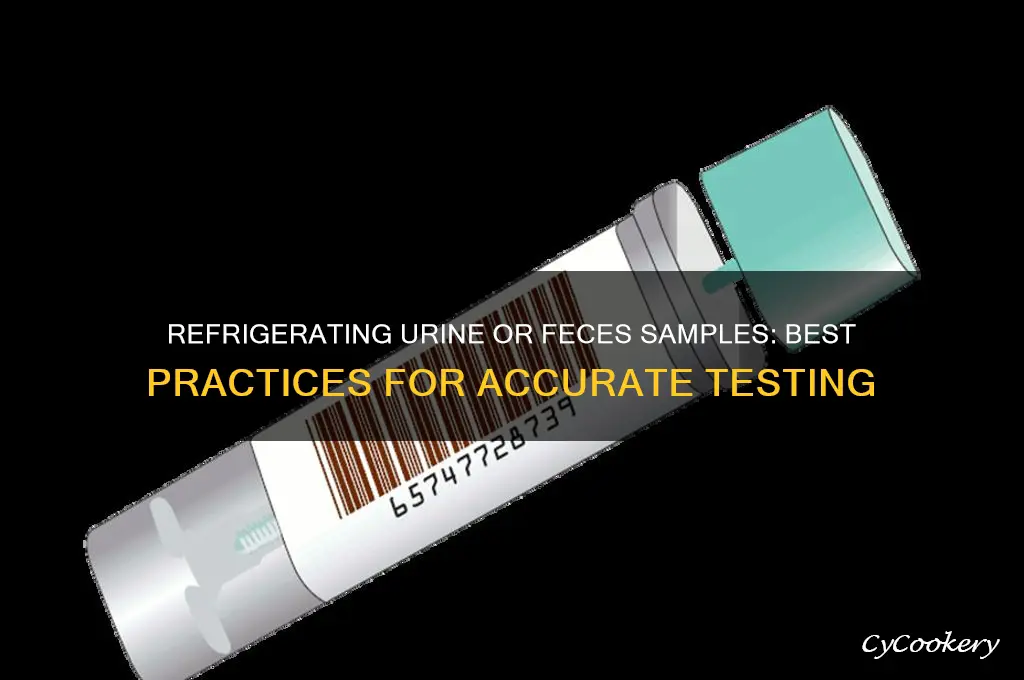 should urine or feces sample be refrigerated