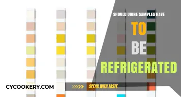 Refrigerating Urine Samples: Necessary Step or Unnecessary Hassle?